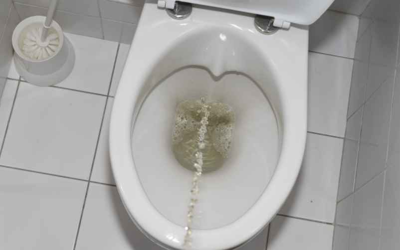 Leucocytes élevés dans les urines causes sans infection urinaire